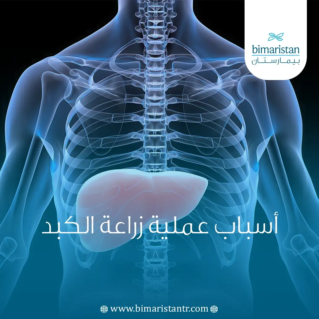 أسباب عملية زراعة الكبد