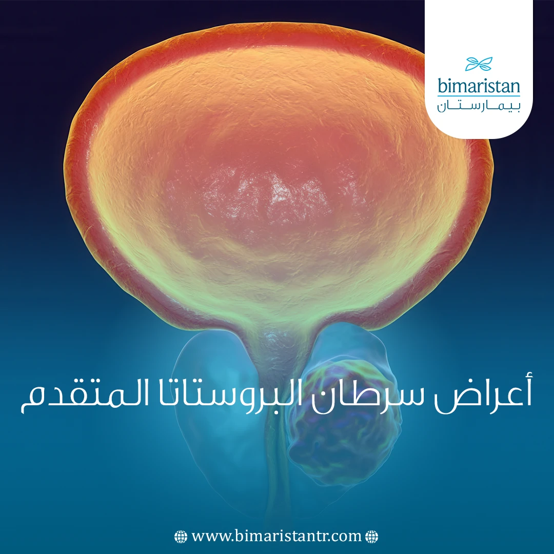 أعراض سرطان البروستاتا المتقدم