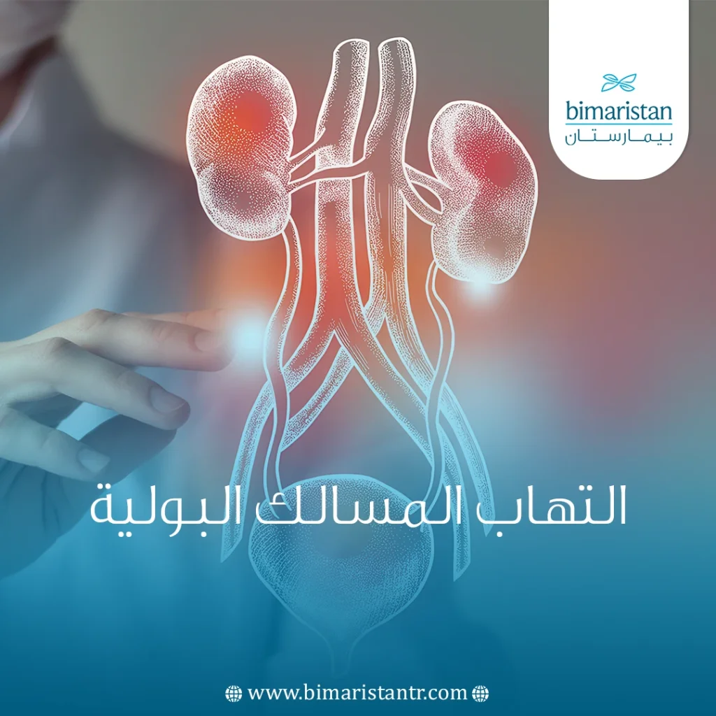 التهاب المسالك البولية