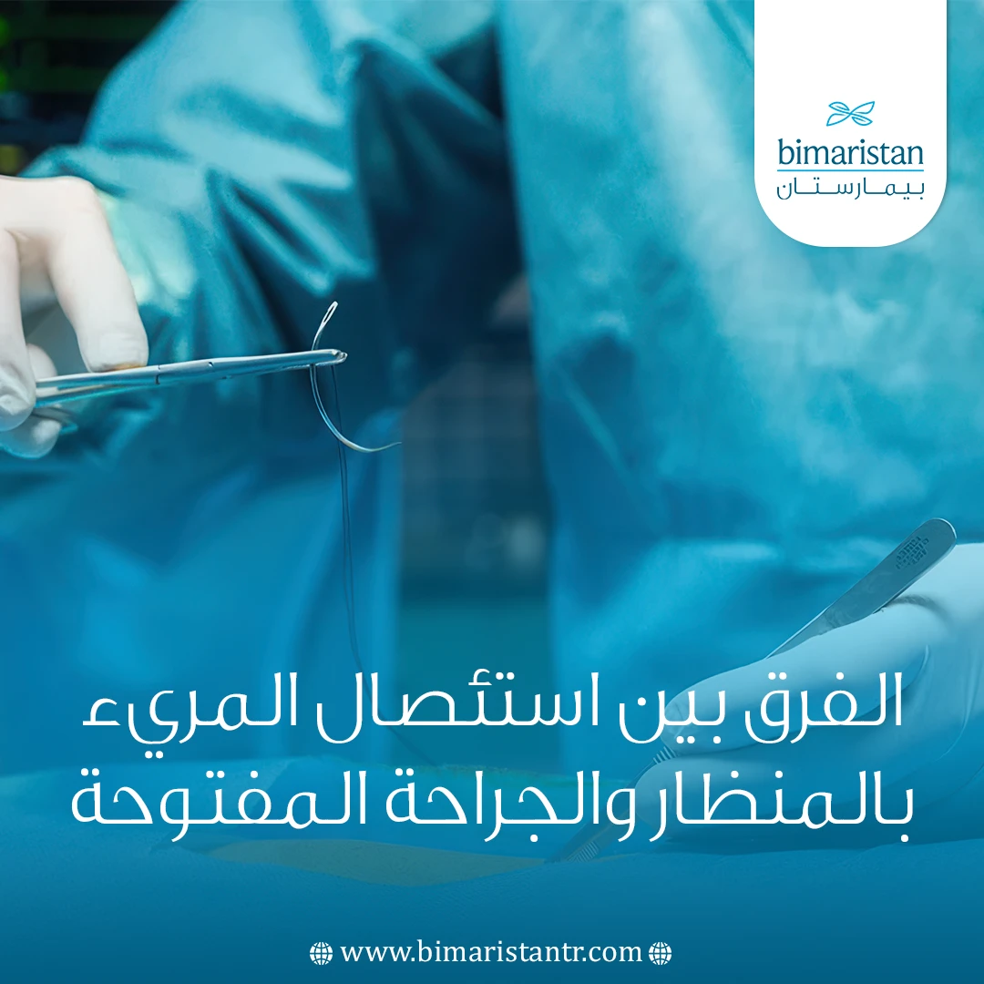 الفرق بين استئصال المريء بالمنظار والجراحة المفتوحة