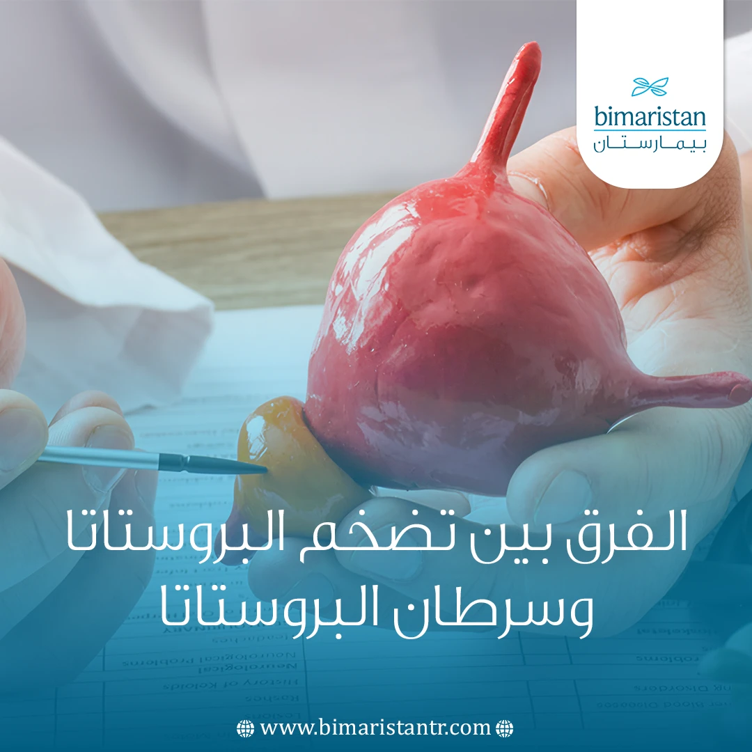 الفرق بين تضخم البروستاتا وسرطان البروستاتا