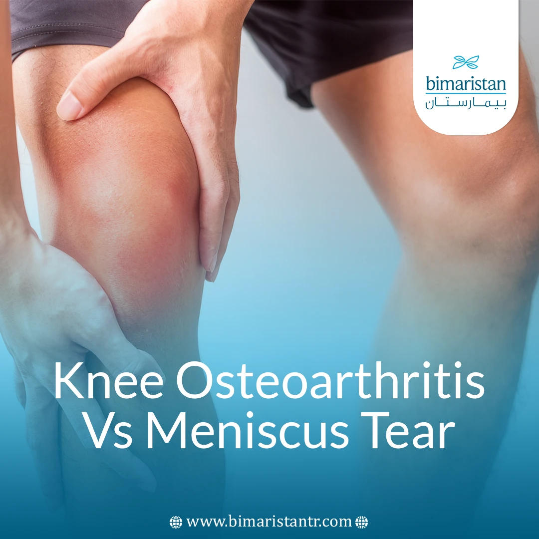 Knee Osteoarthritis Vs Meniscus Tear