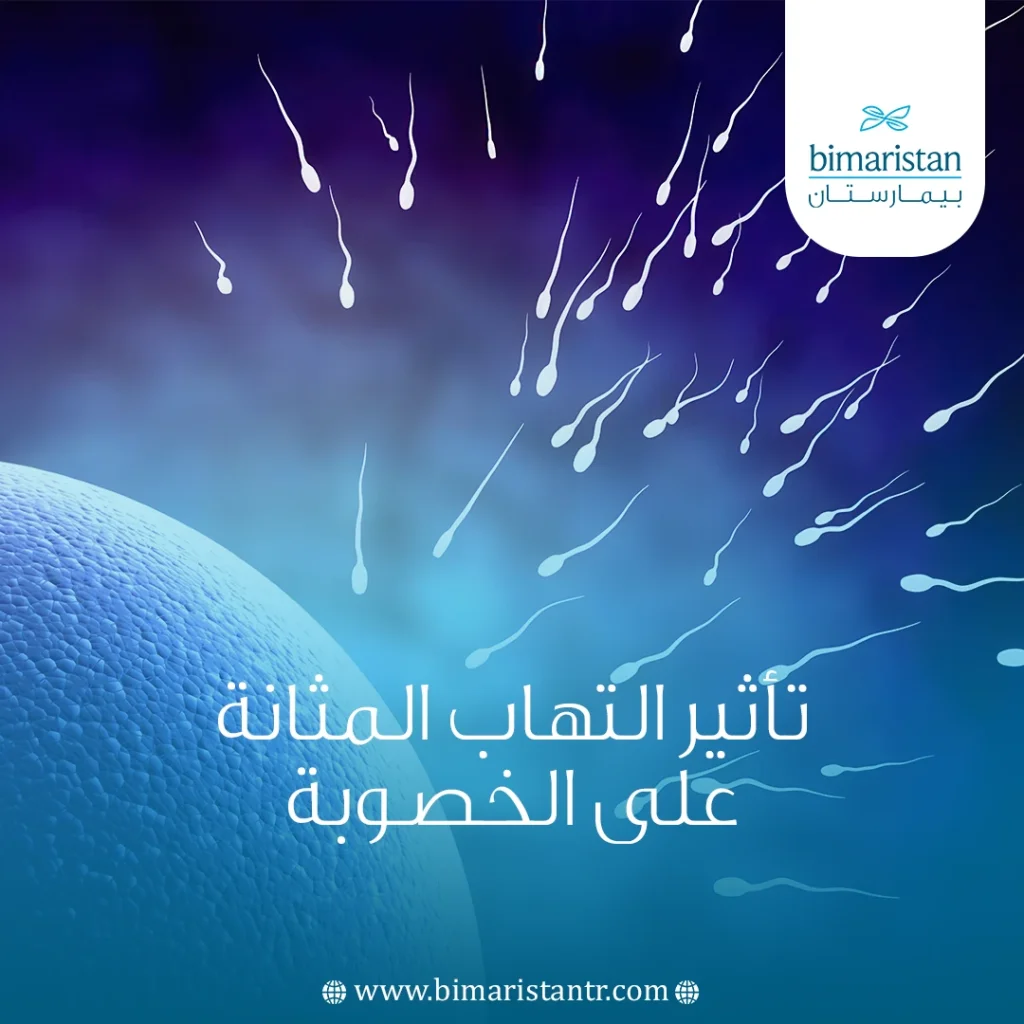تأثير التهاب المثانة على الخصوبة
