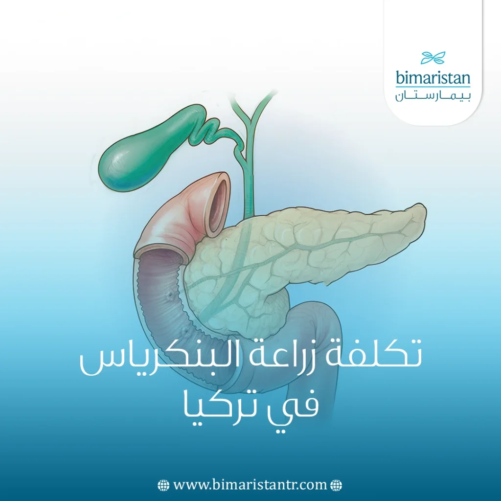 تكلفة زراعة البنكرياس في تركيا