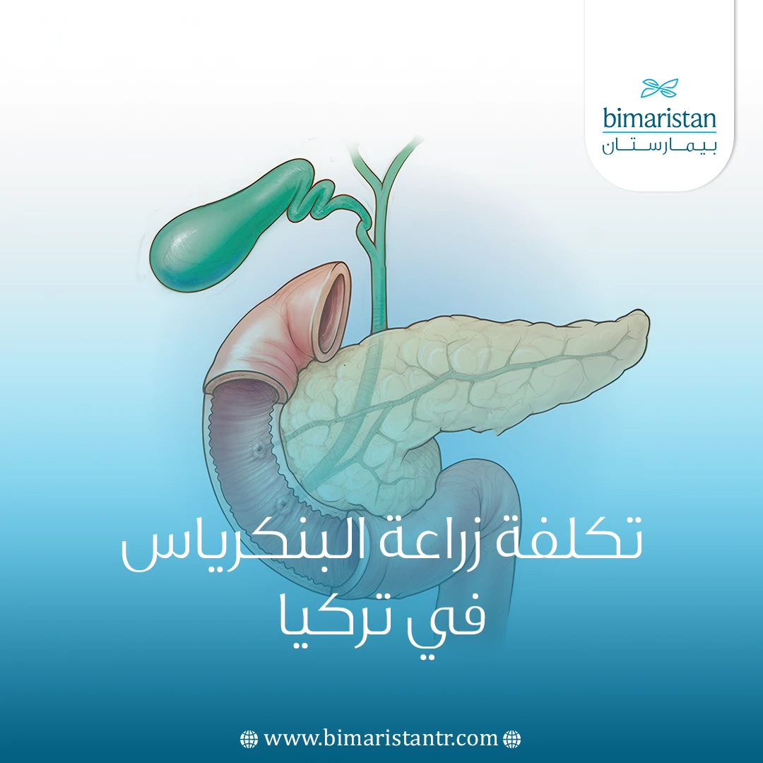 تكلفة زراعة البنكرياس في تركيا: الدليل الشامل 2025