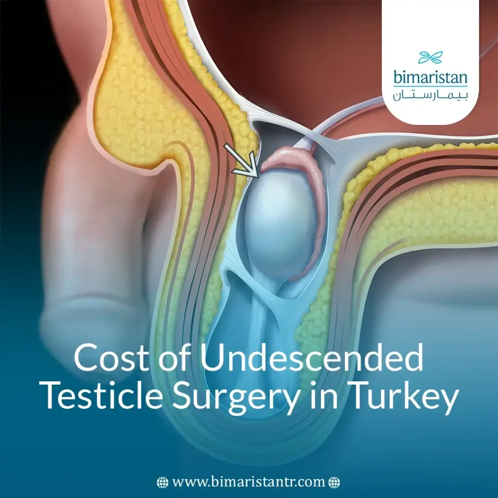 Cost Of Undescended Testicle Surgery In Turkey: Guide
