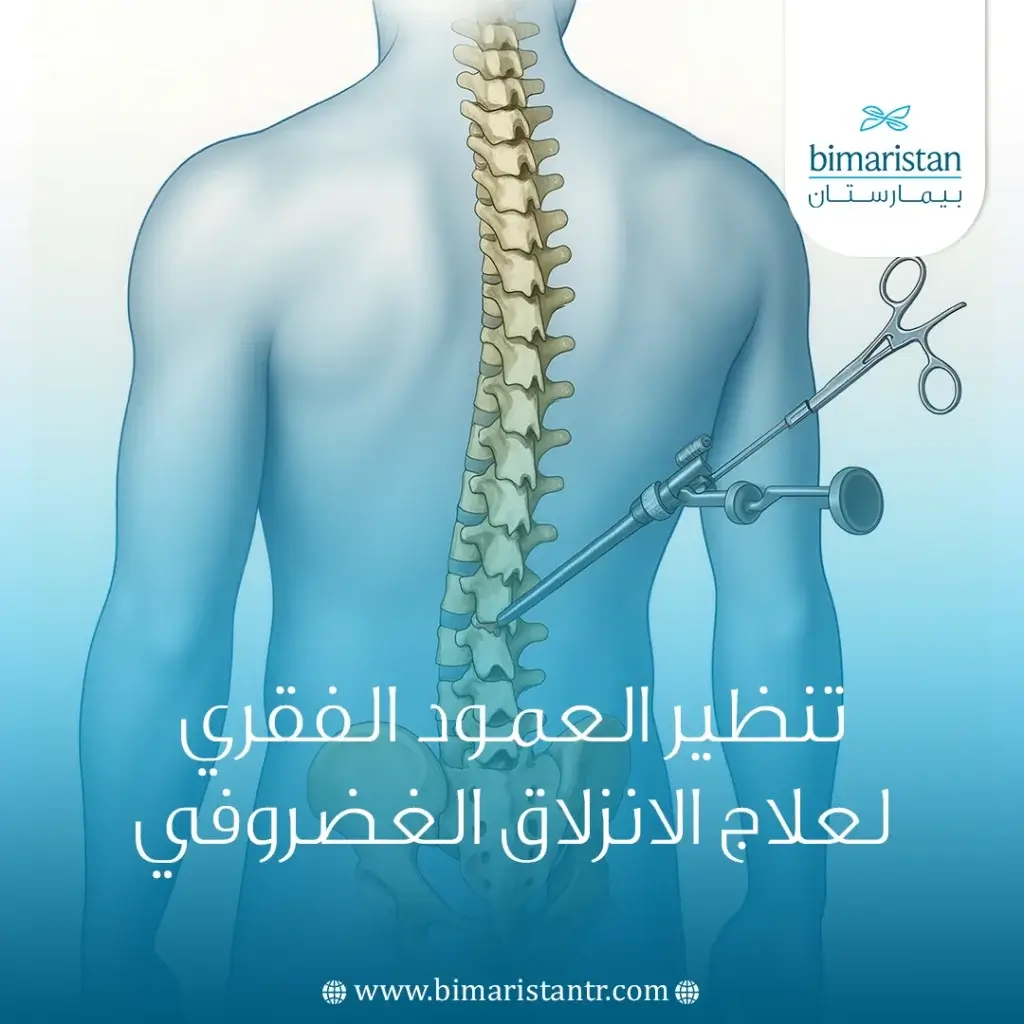تنظير العمود الفقري لعلاج الانزلاق الغضروفي