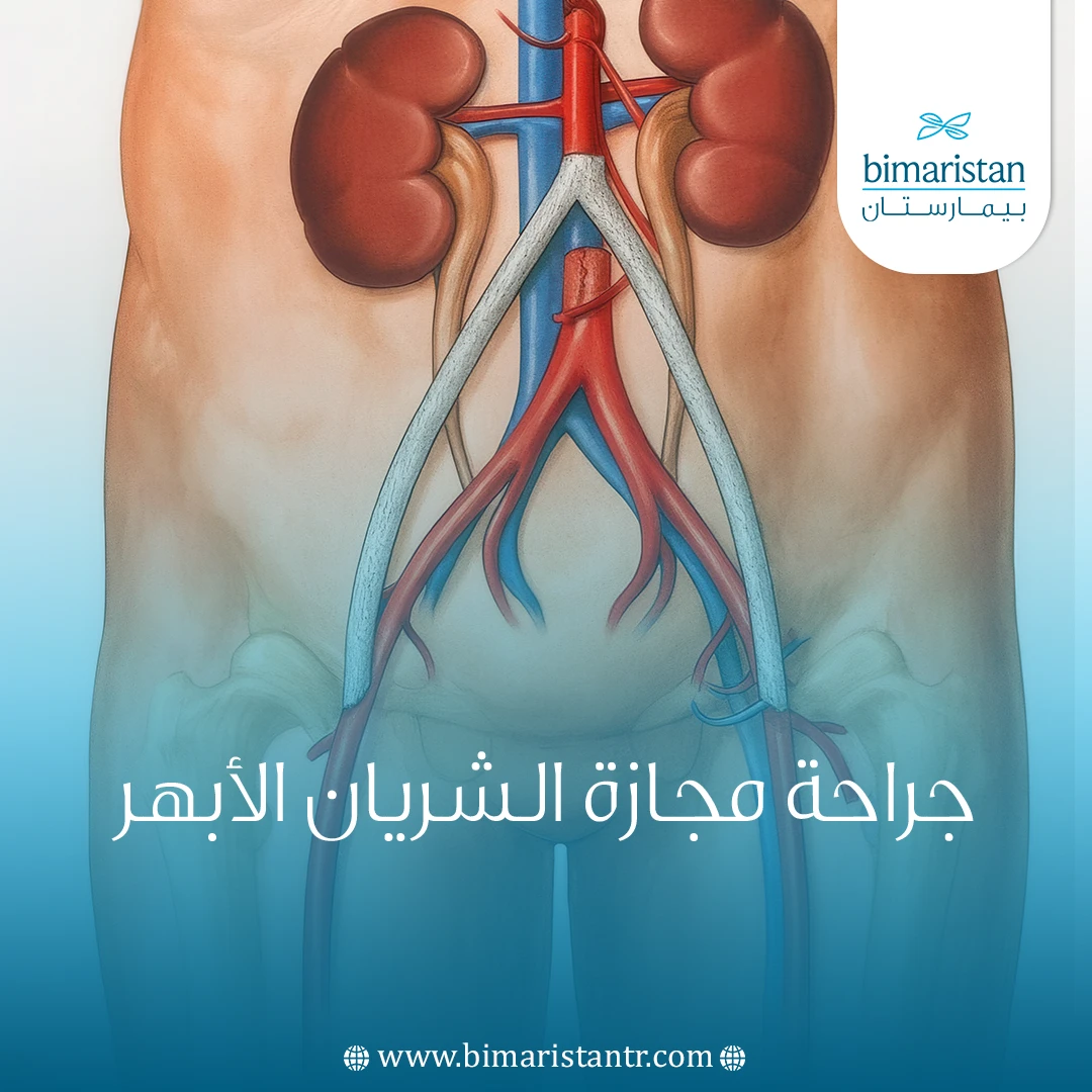 جراحة مجازة الشريان الأبهر