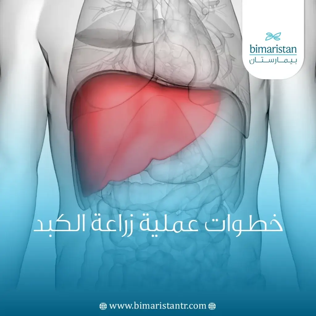 خطوات عملية زراعة الكبد