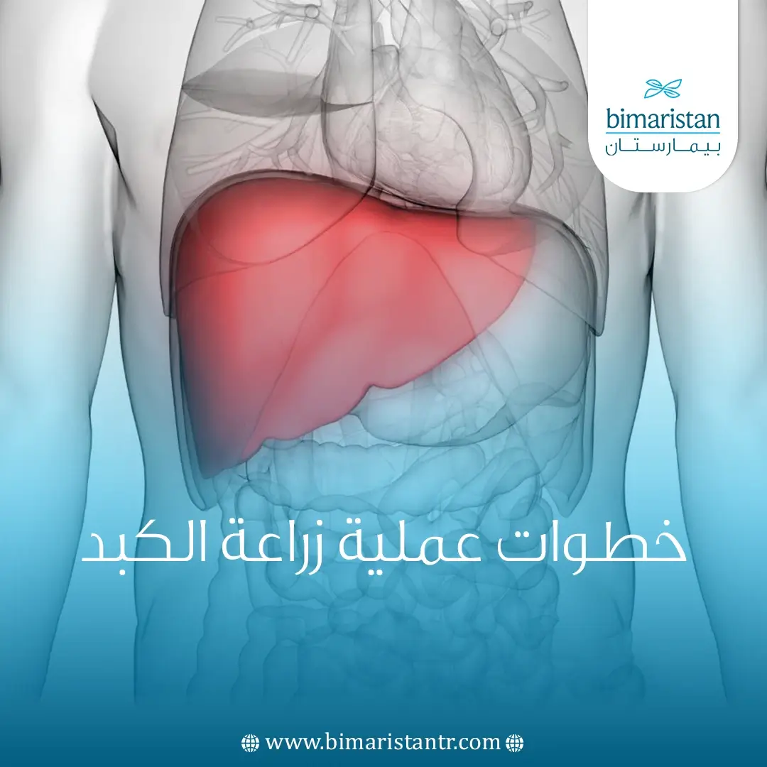 خطوات عملية زراعة الكبد