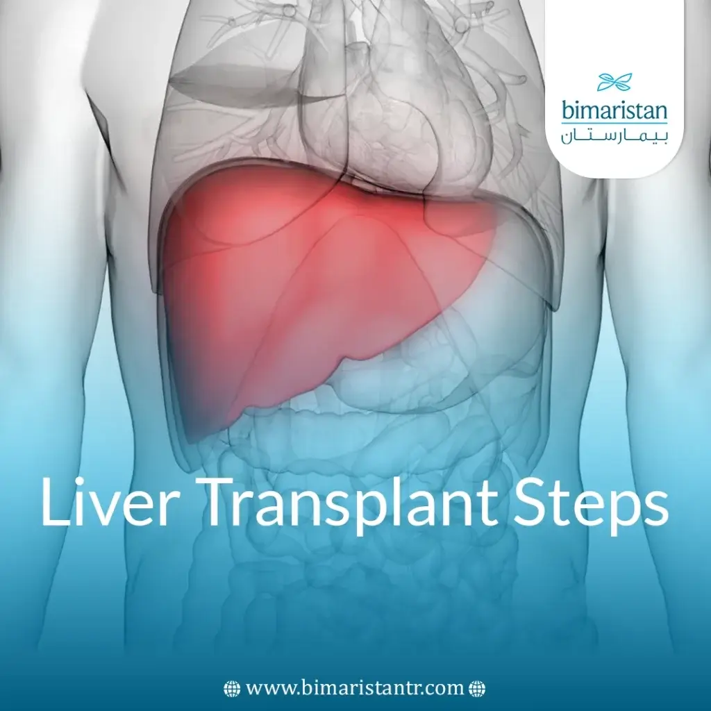 A Comprehensive Guide To Liver Transplant Surgery: Causes, Steps, Conditions, And Complications 6 Liver Transplant Steps