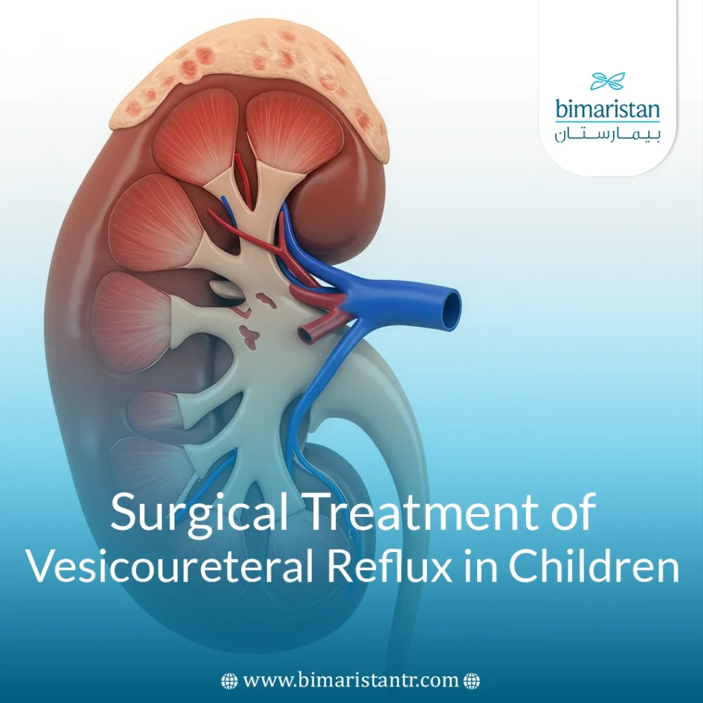 Surgical Treatment Of Vesicoureteral Reflux In Children