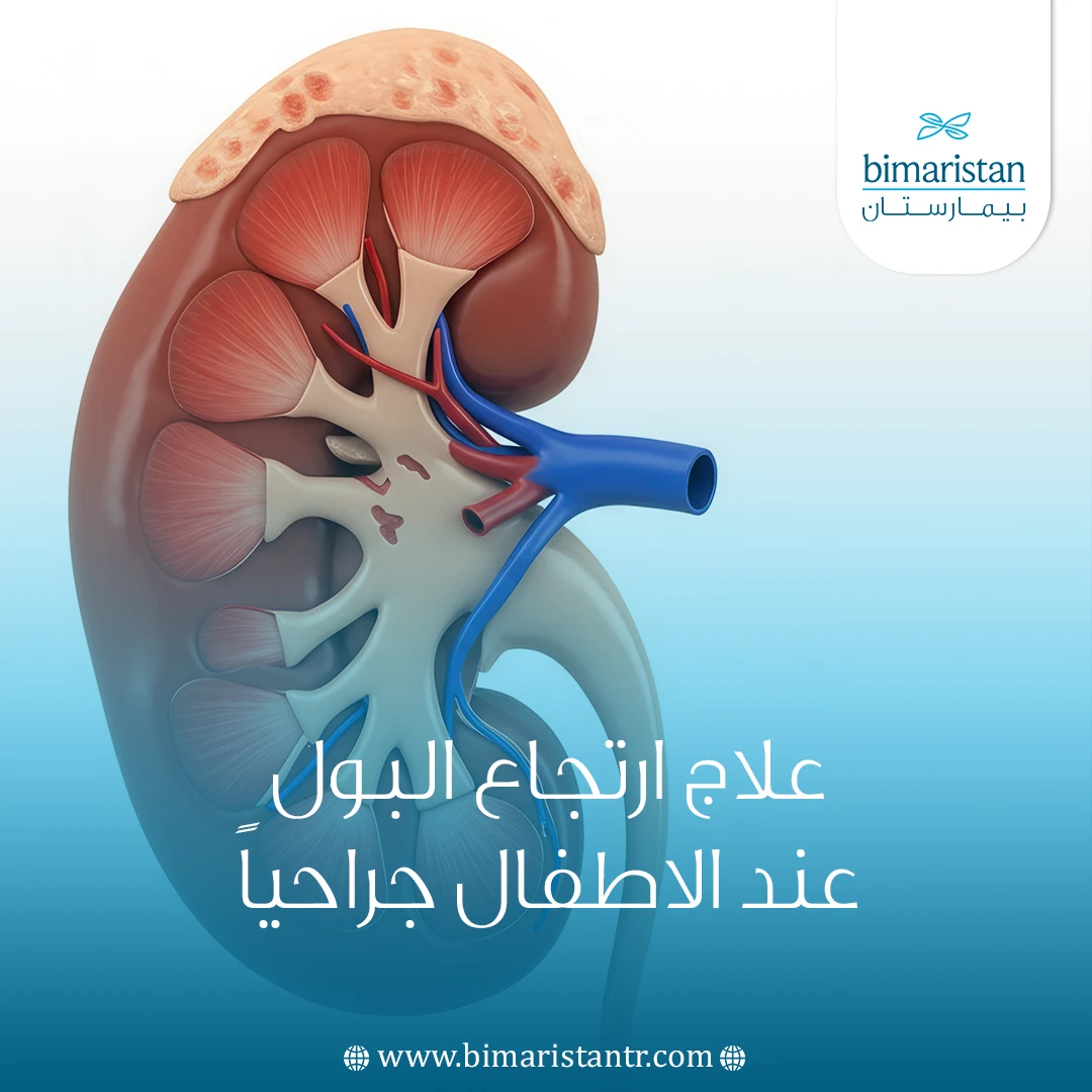 علاج ارتجاع البول عند الاطفال جراحياً