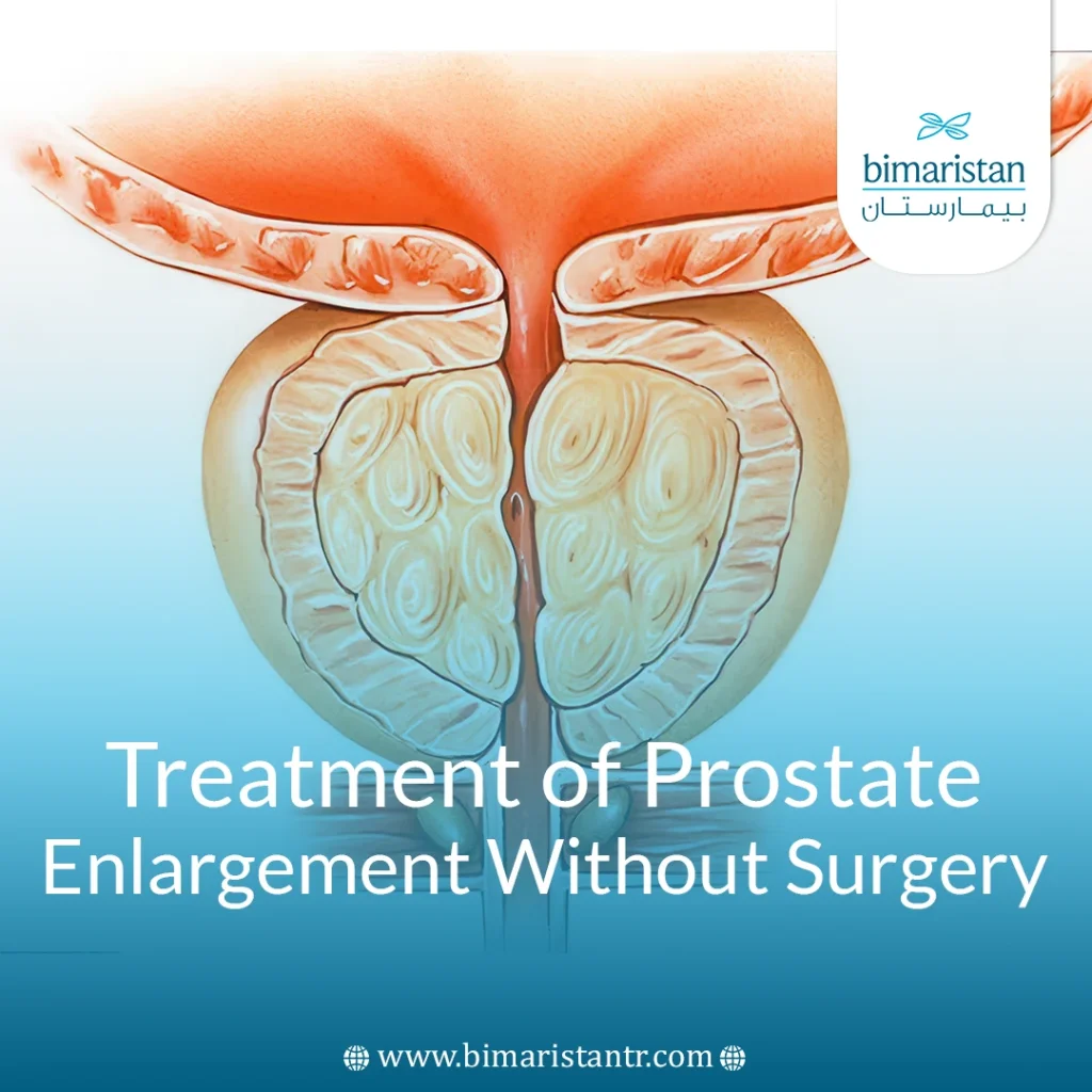 Treatment Of Prostate Enlargement Without Surgery