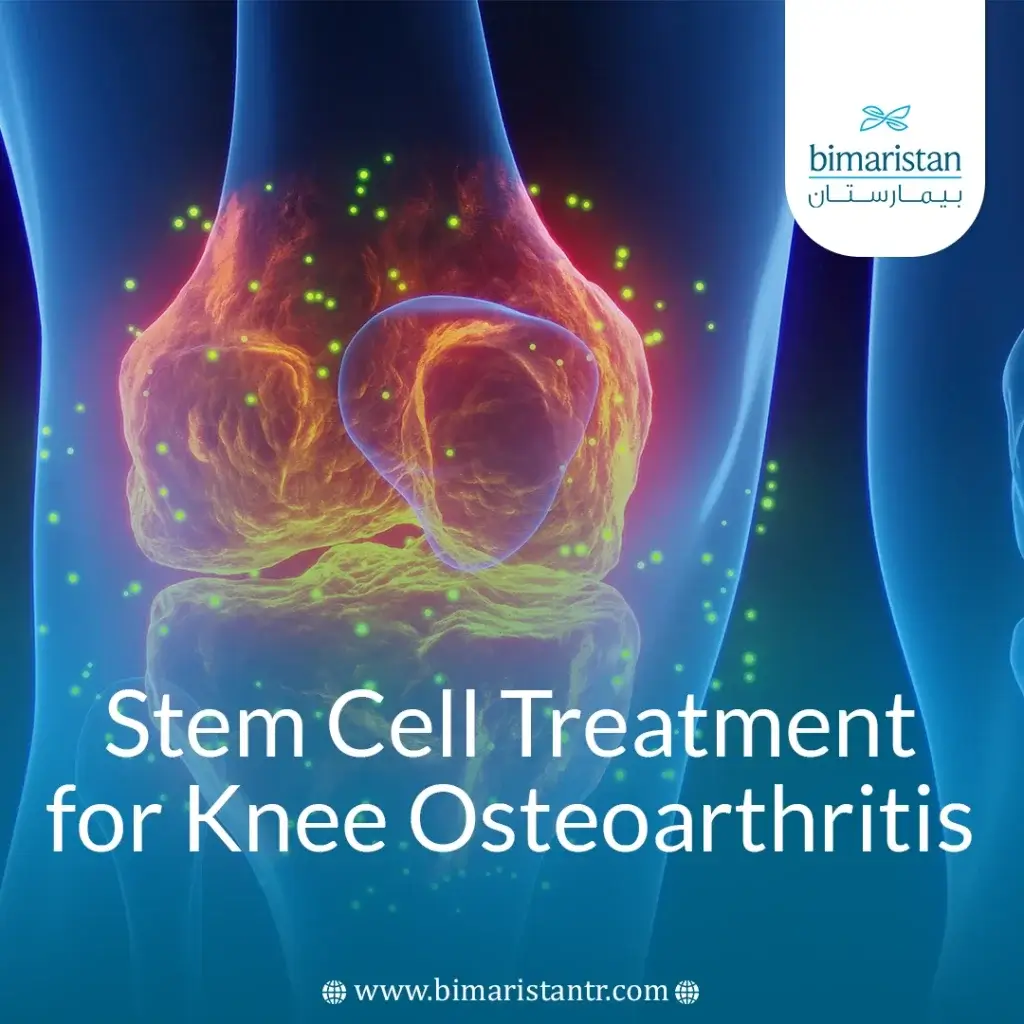 Stem Cell Treatment For Knee Osteoarthritis: Relief &Amp; Repair