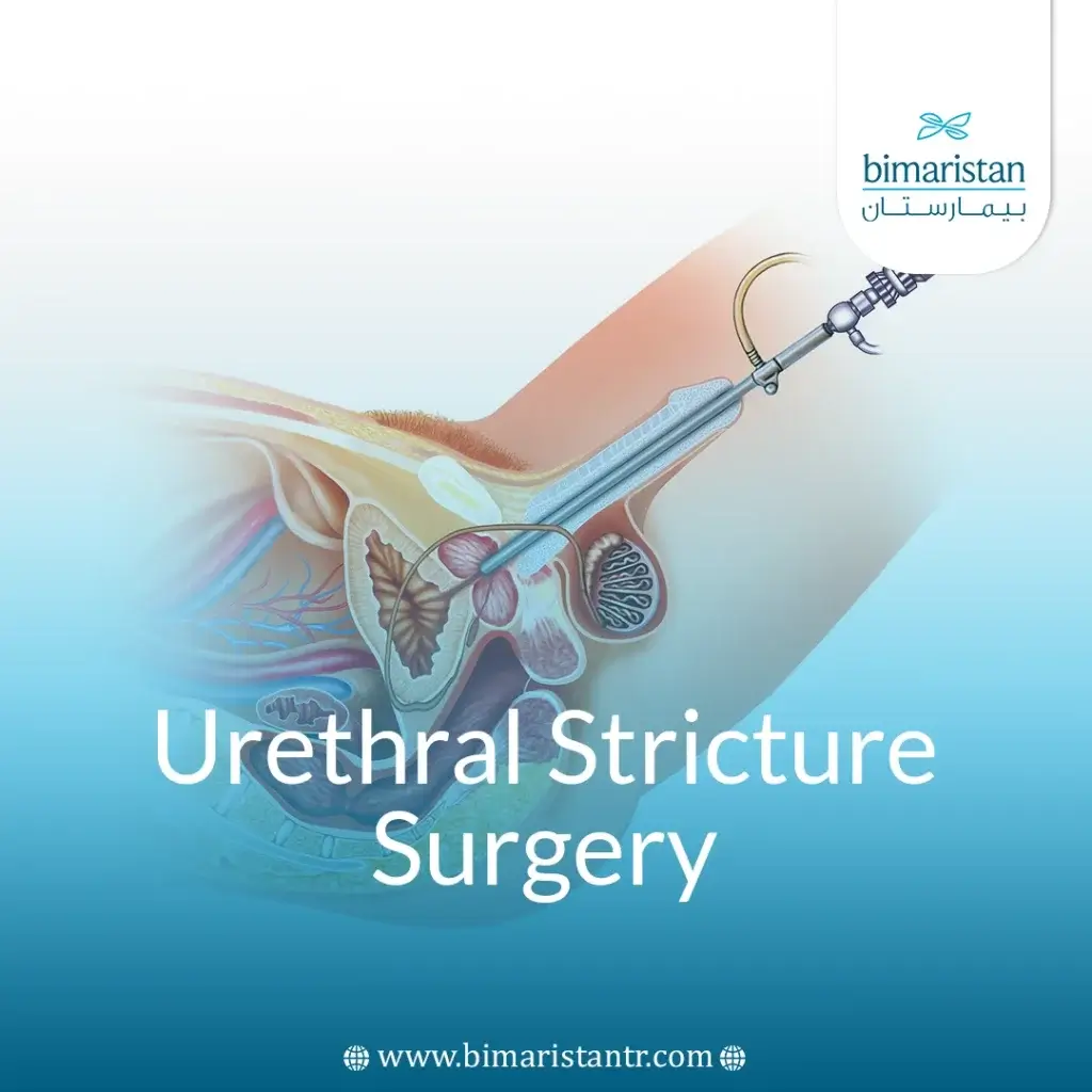Surgical Urethral Stricture Treatment: Causes &Amp; Options