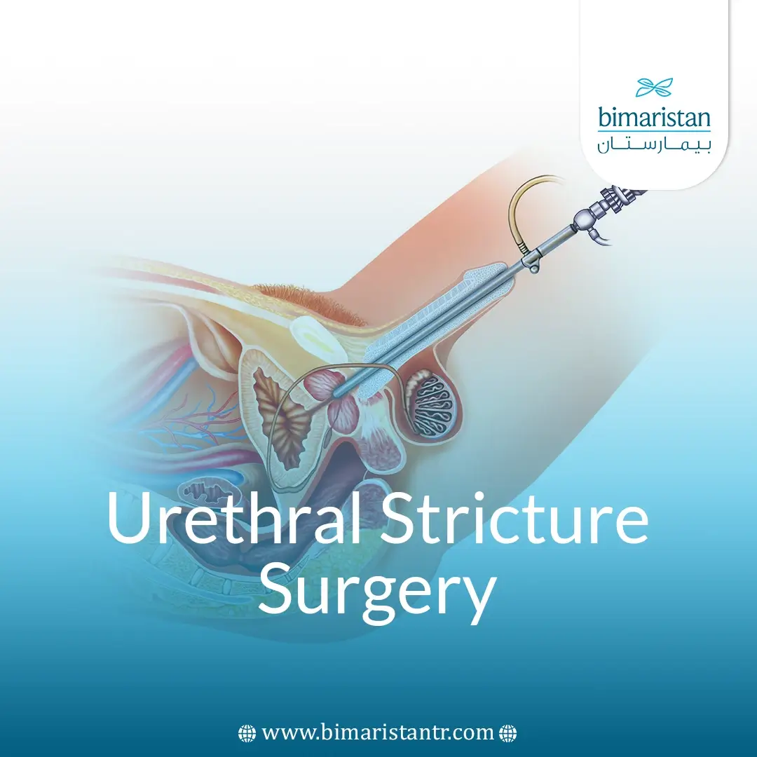 Surgical Urethral Stricture Treatment: Causes &Amp;Amp; Options