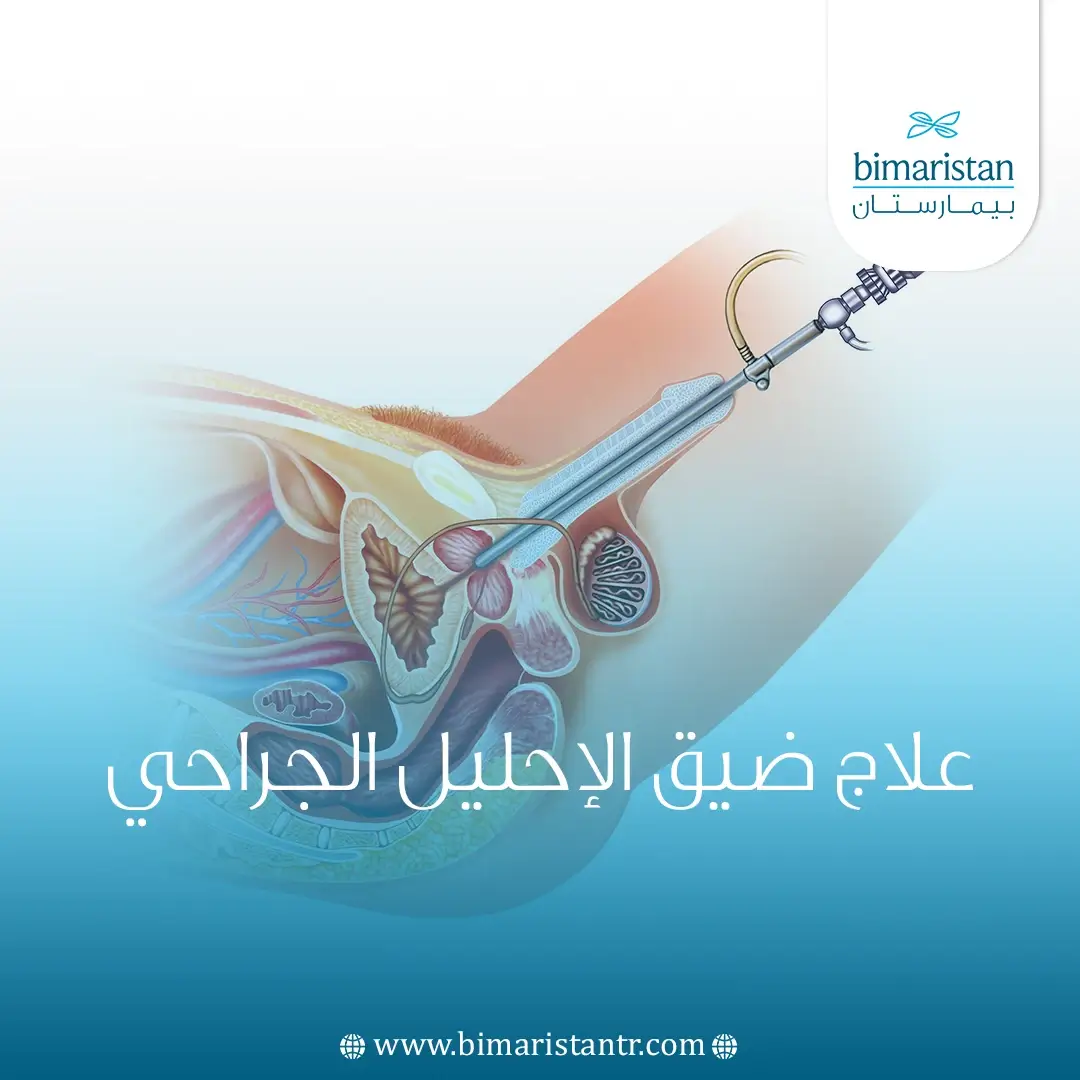 علاج ضيق الإحليل الجراحي