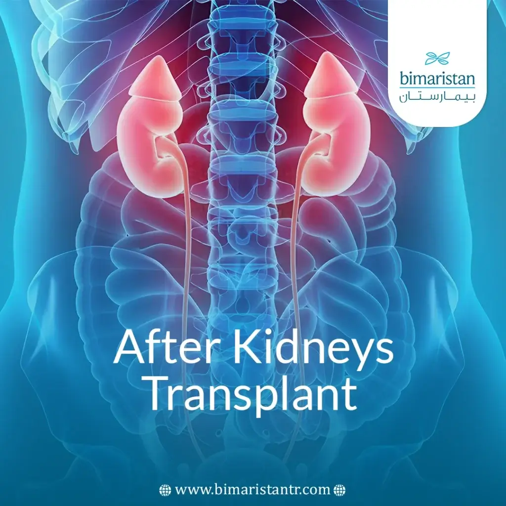 After A Kidney Transplant: The Comprehensive Guide 2025
