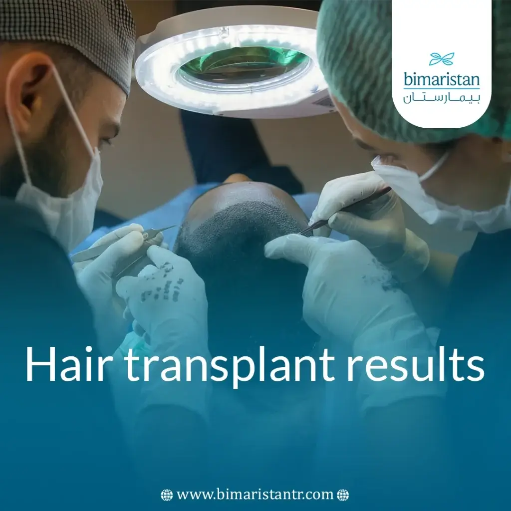 Hair Transplant Results