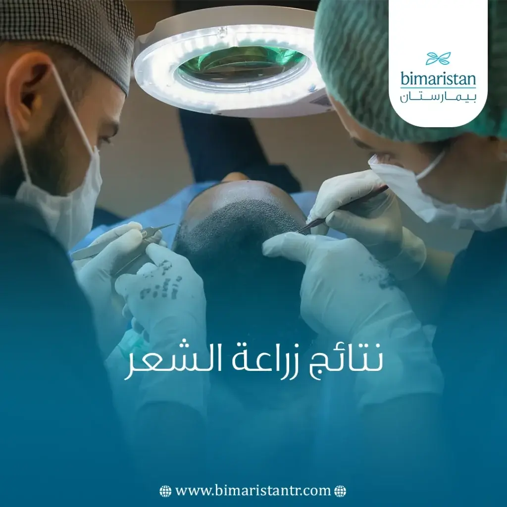 نتائج زراعة الشعر