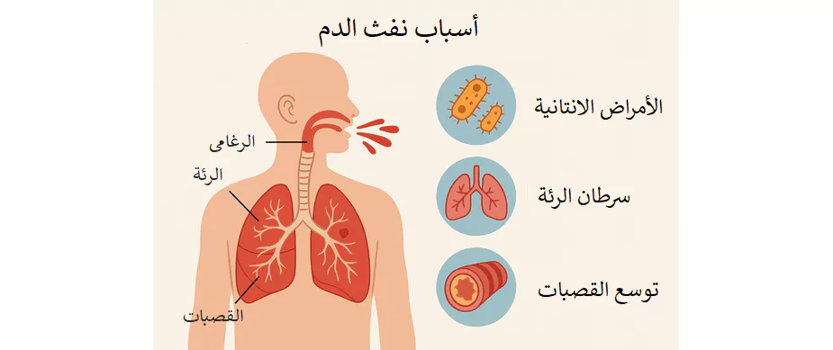 أشهر أسباب نفث الدم