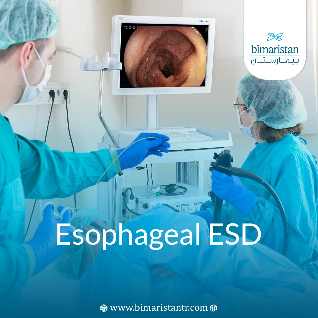 Esophageal Esd