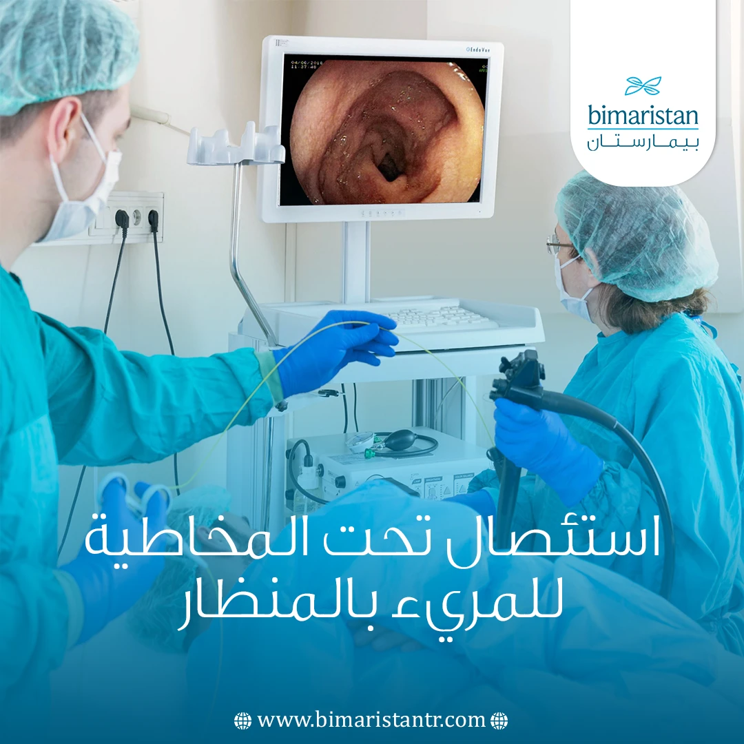 استئصال تحت المخاطية للمريء بالمنظار