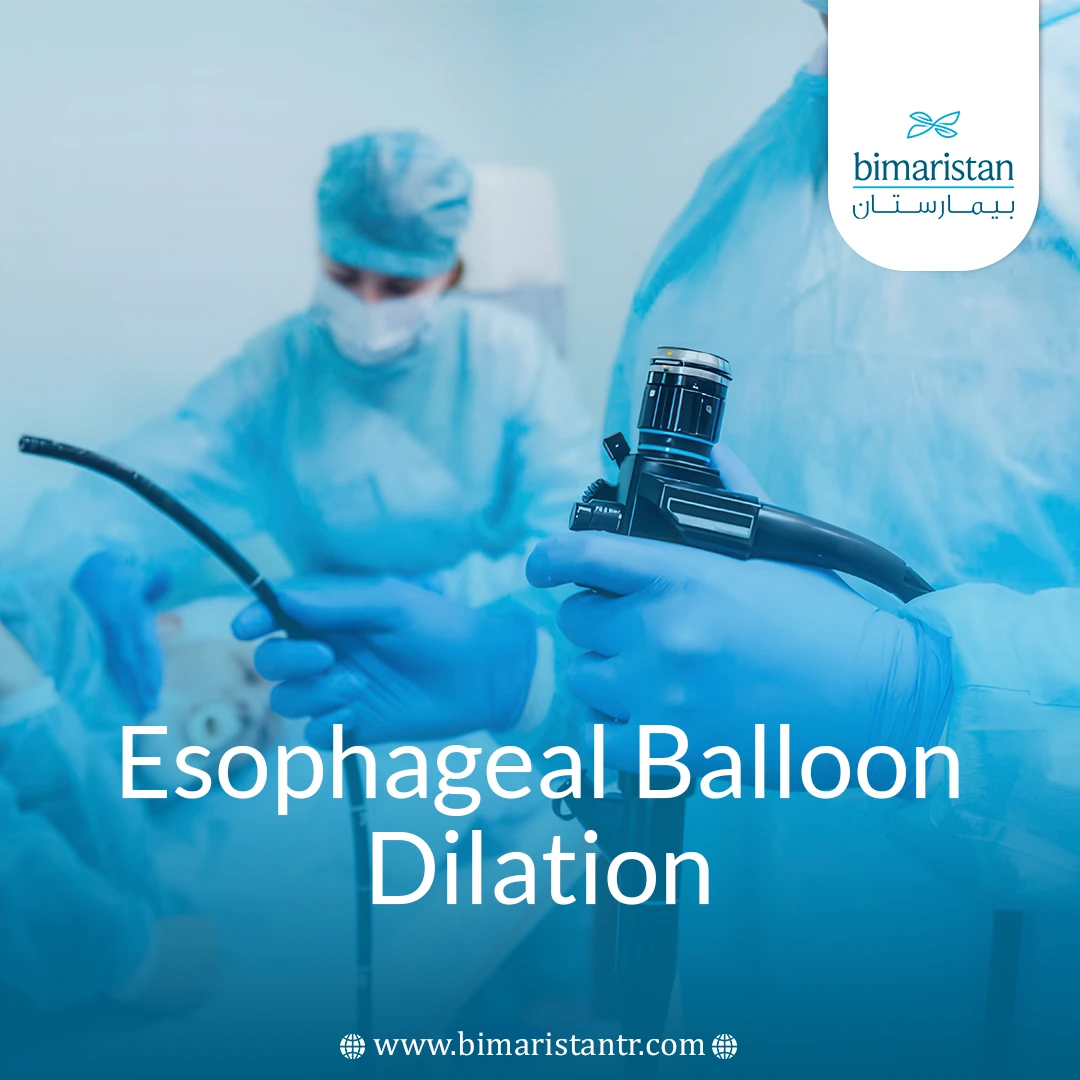 Esophageal Balloon Dilation: Everything You Need To Know