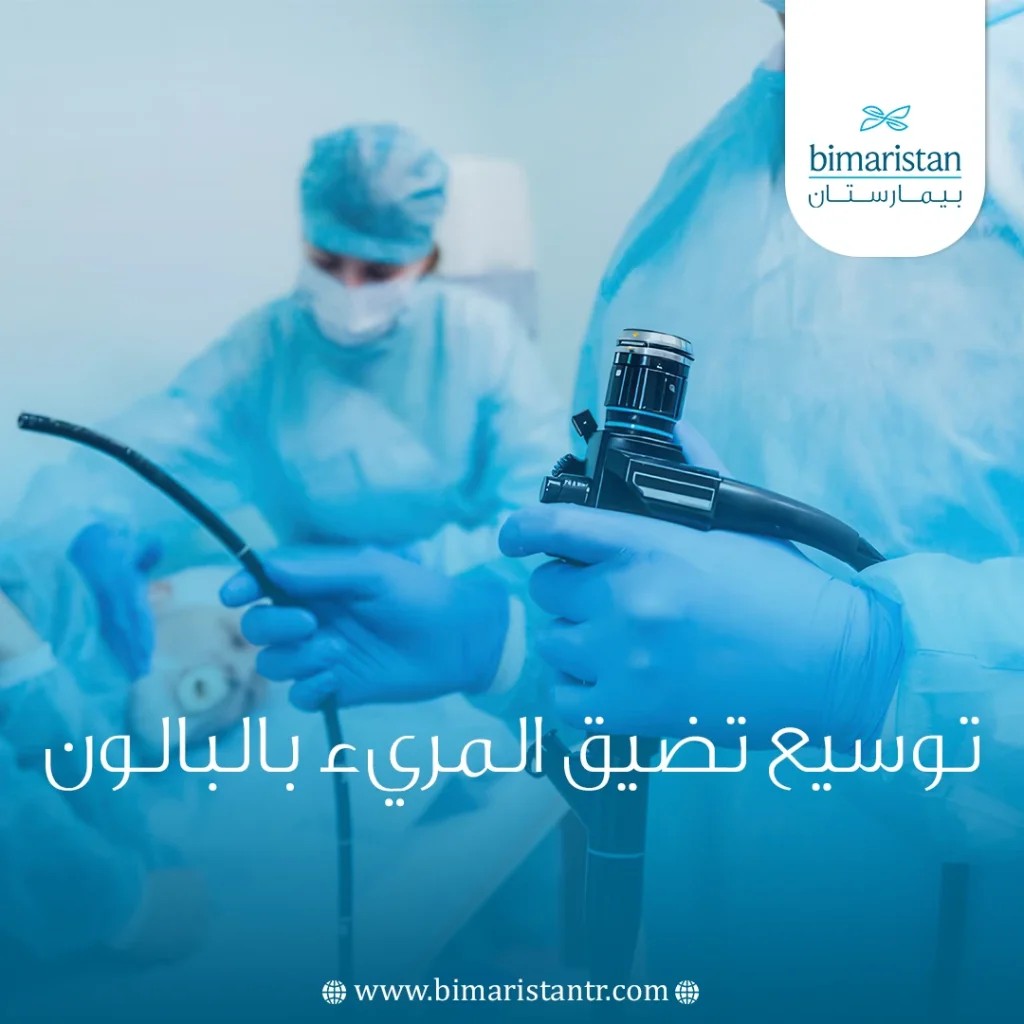 توسيع تضيق المريء بالبالون