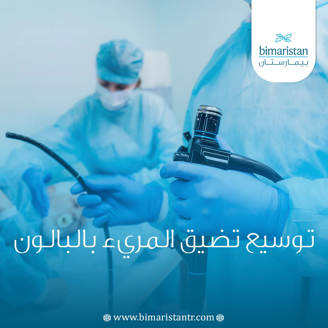 توسيع تضيق المريء بالبالون