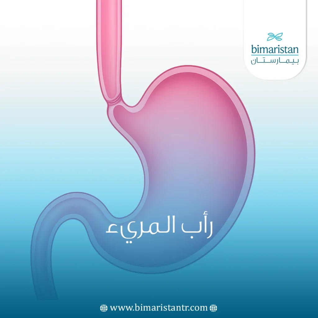 رأب المريء