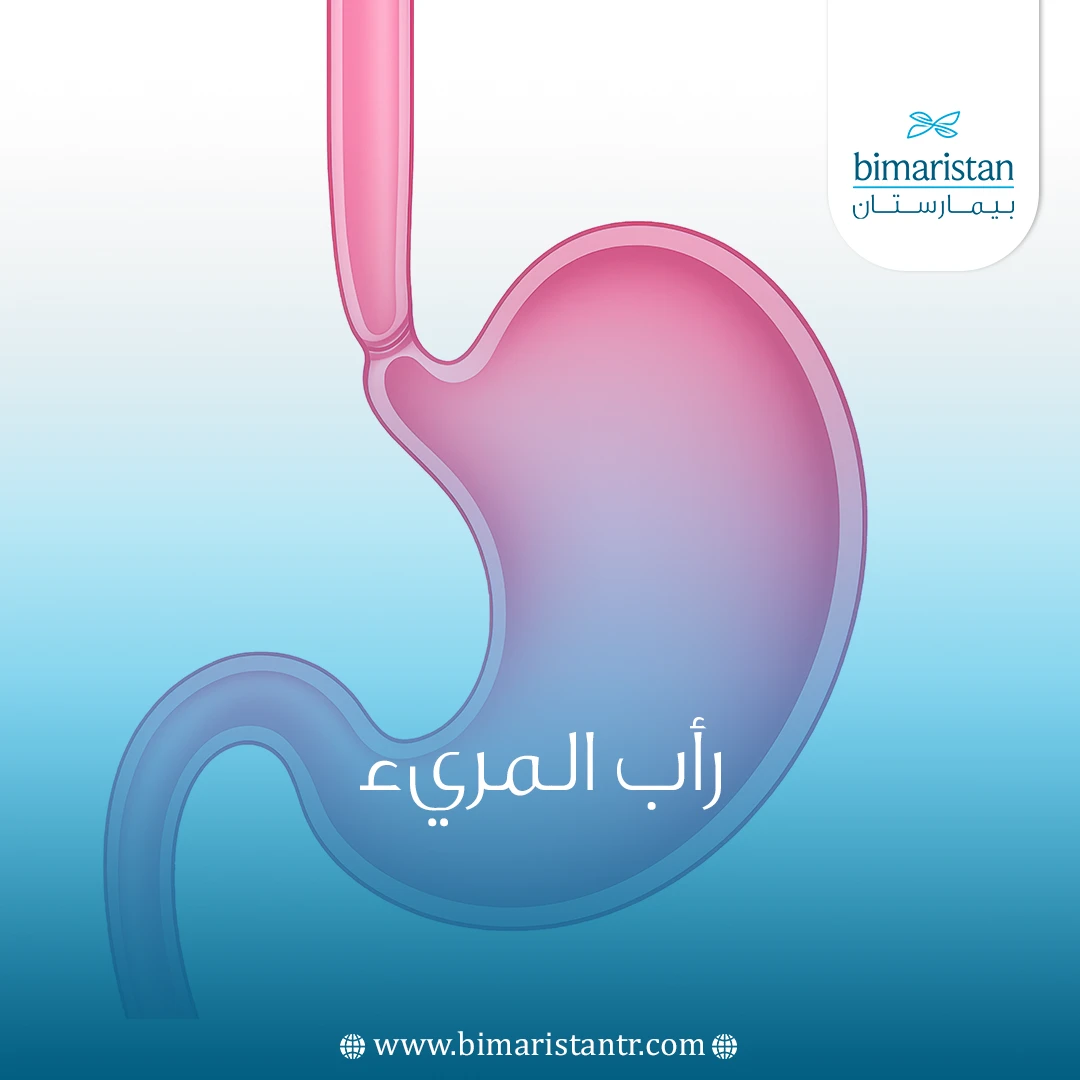 رأب المريء