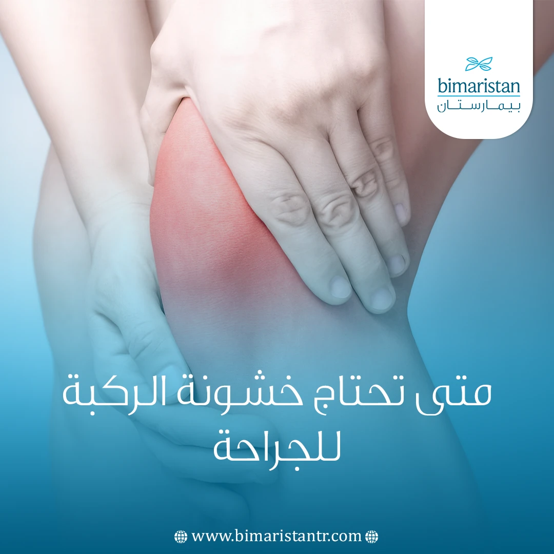 متى تحتاج خشونة الركبة للجراحة