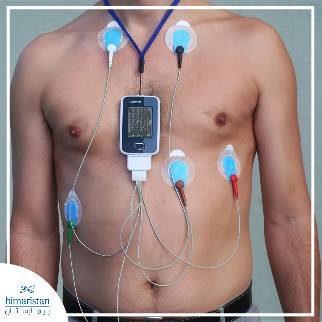 Heart Palpitations At Rest Causes Explained: From Symptoms To Solutions 3 Image Showing A Holter Monitor Used To Monitor Heart Rate Around The Clock