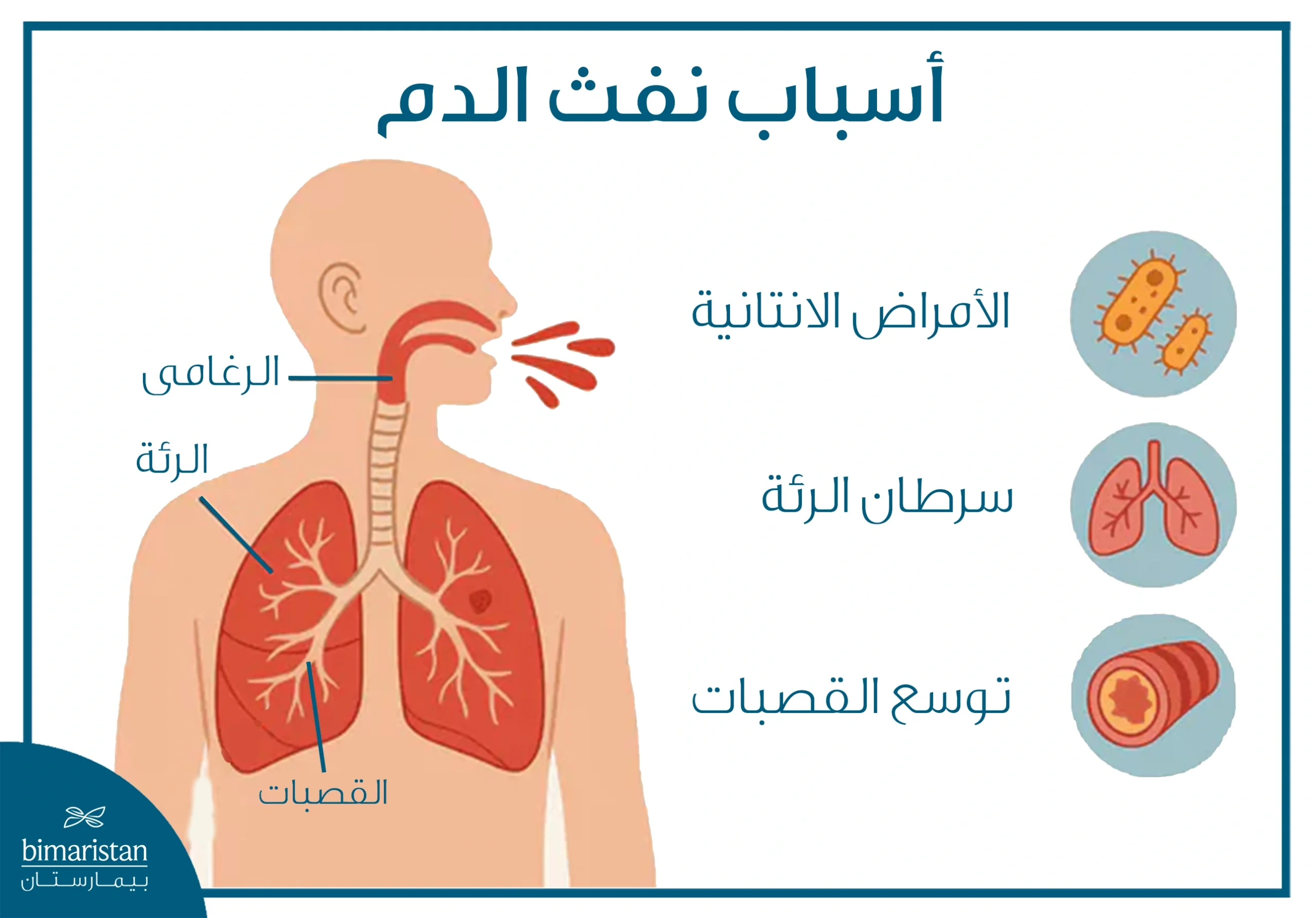أسباب نفث الدم