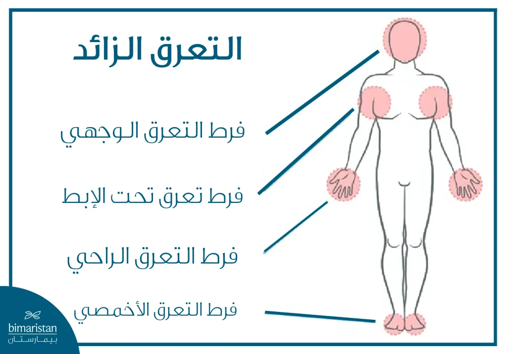 أماكن فرط التعرق