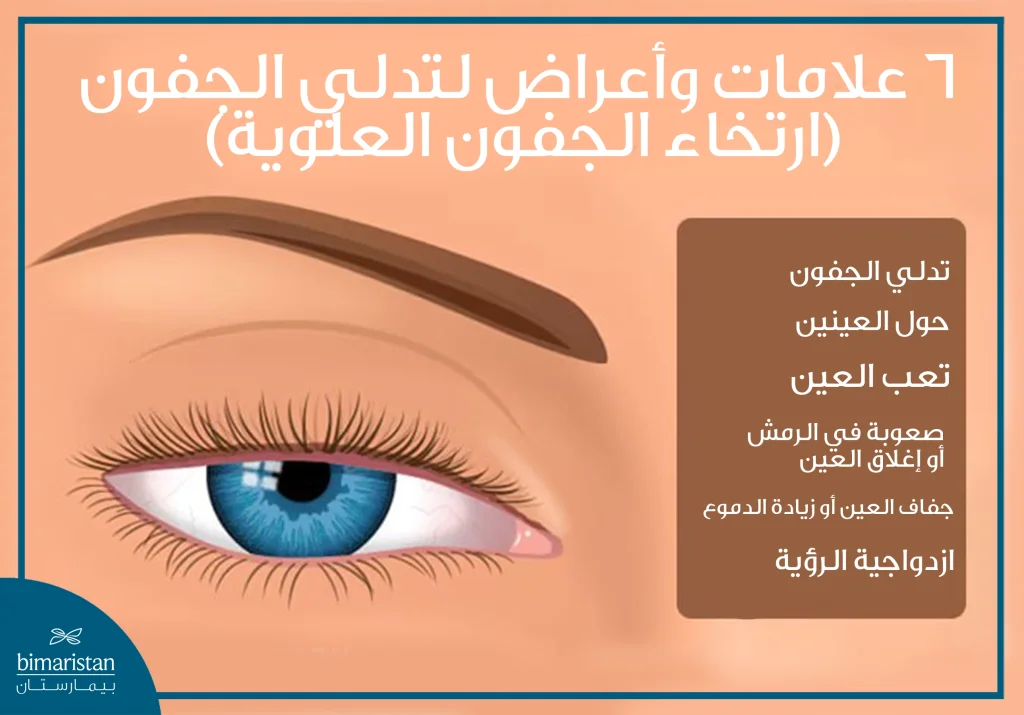 الصورة توضح 6 أعراض وعلامات لتدلي الجفون عند البالغين والأطفال