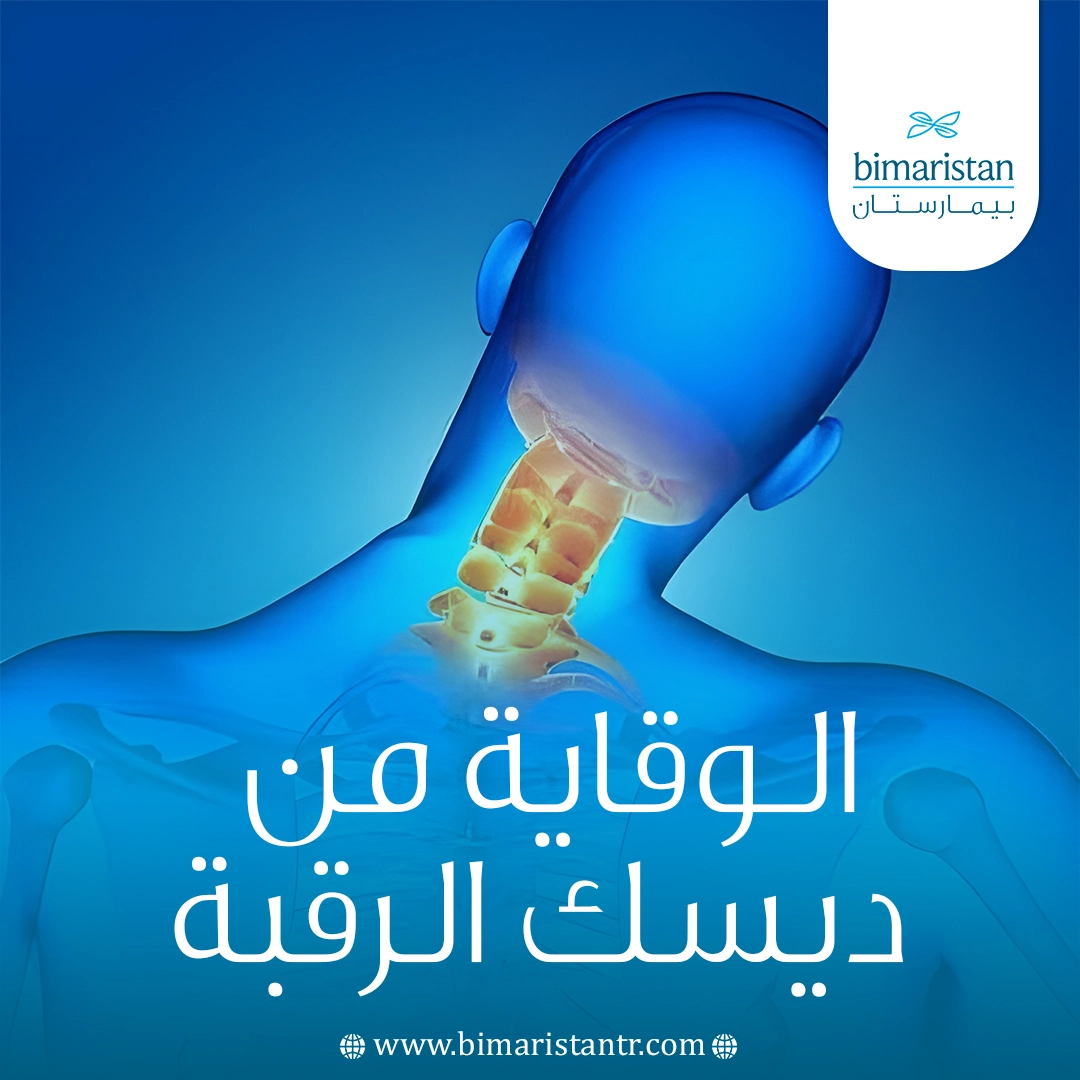 الوقاية من ديسك الرقبة