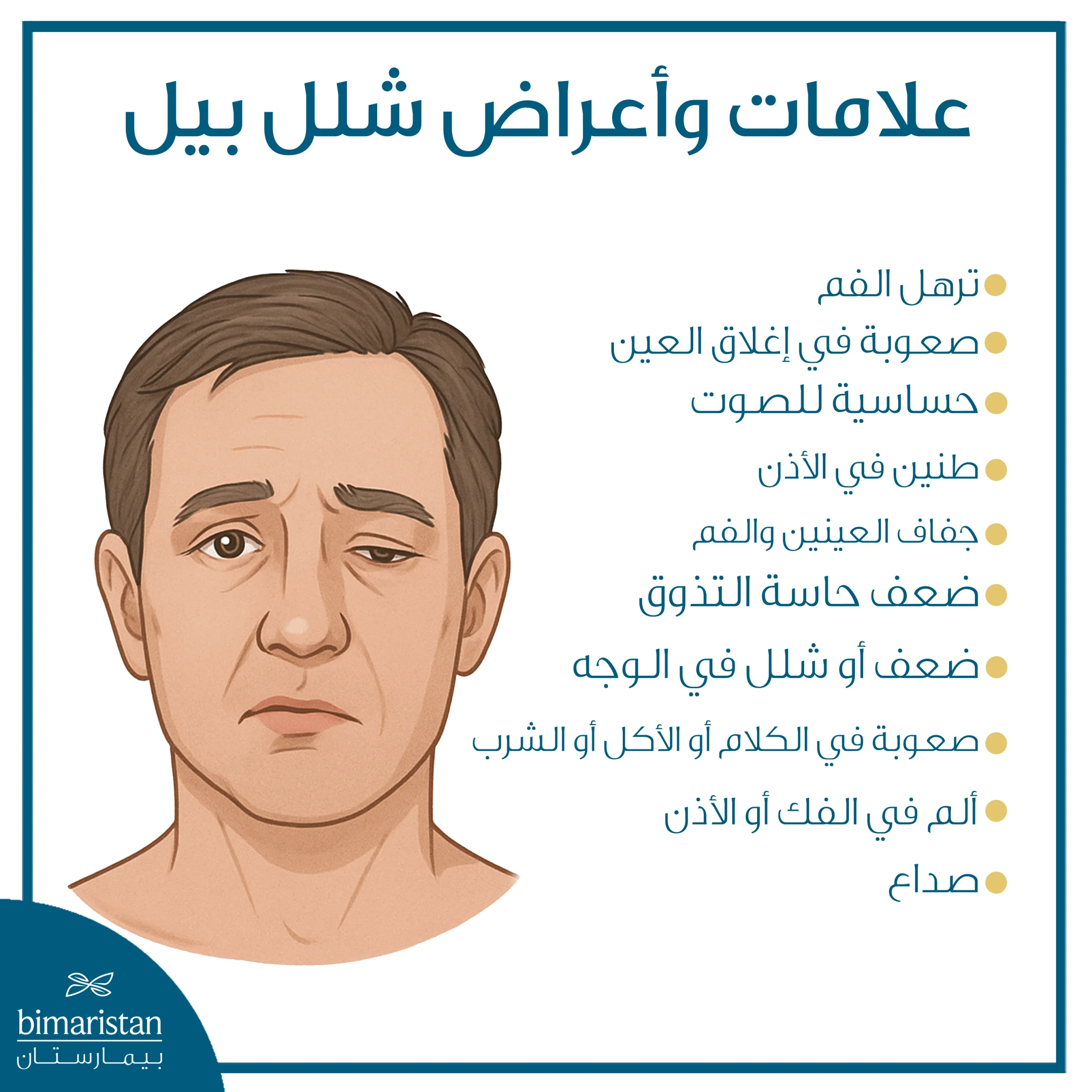 شلل العصب الوجهي: أسبابه وعلاجه 3 توضح الصورة أهم أعراض شلل بيل