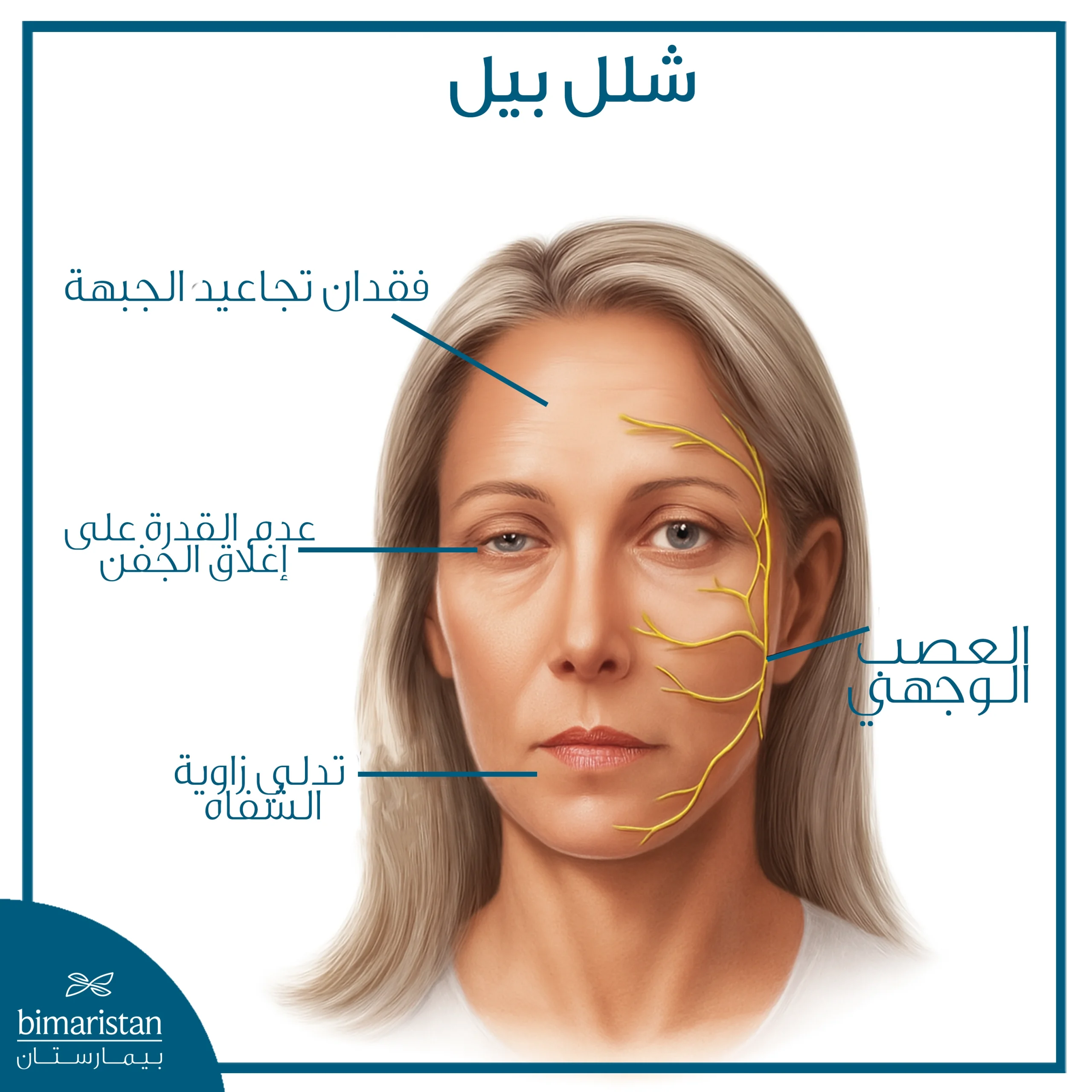 شلل العصب الوجهي: أسبابه وعلاجه 2 توضح الصورة موقع العصب الوجهي وبعض أعراض شلل بيل