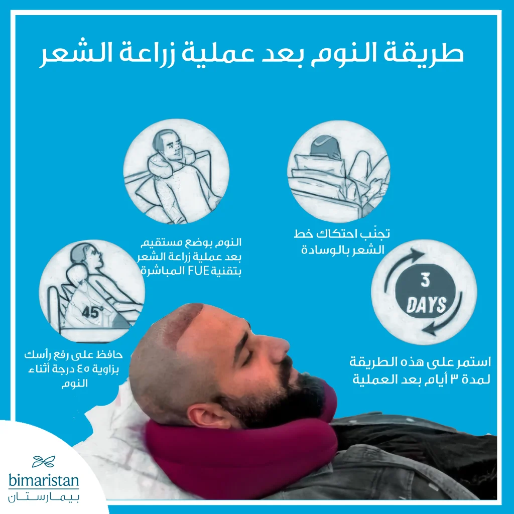 العناية بعد زراعة الشعر: دليلك الشامل لضمان أفضل النتائج 3 توضّح الصورة الطريقة الصحيحة للنوم بعد زراعة الشعر لتجنّب تلف البصيلات وتسريع التعافي.