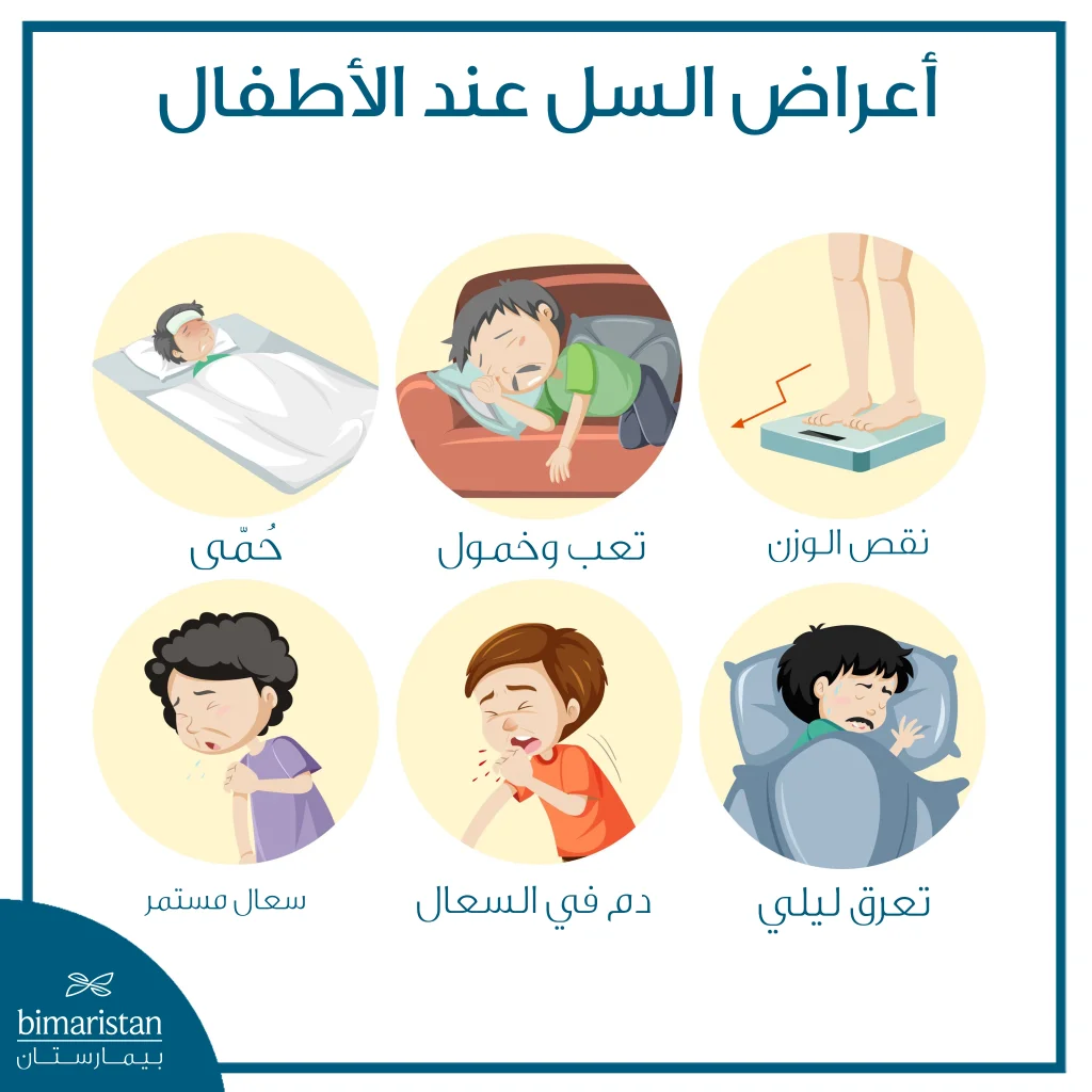 السل عند الأطفال: الأعراض، الأسباب، وطرق العلاج الحديثة 4 رسم توضيحي يُظهر الأعراض الشائعة لمرض السل عند الأطفال