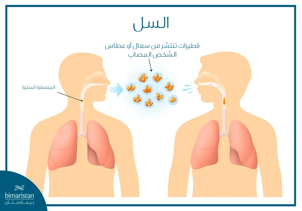 ما هو مرض السل؟ الأسباب، الأنواع، وآلية العدوى 5 رسم يوضّح انتقال عدوى مرض السل عبر القطيرات التنفسية