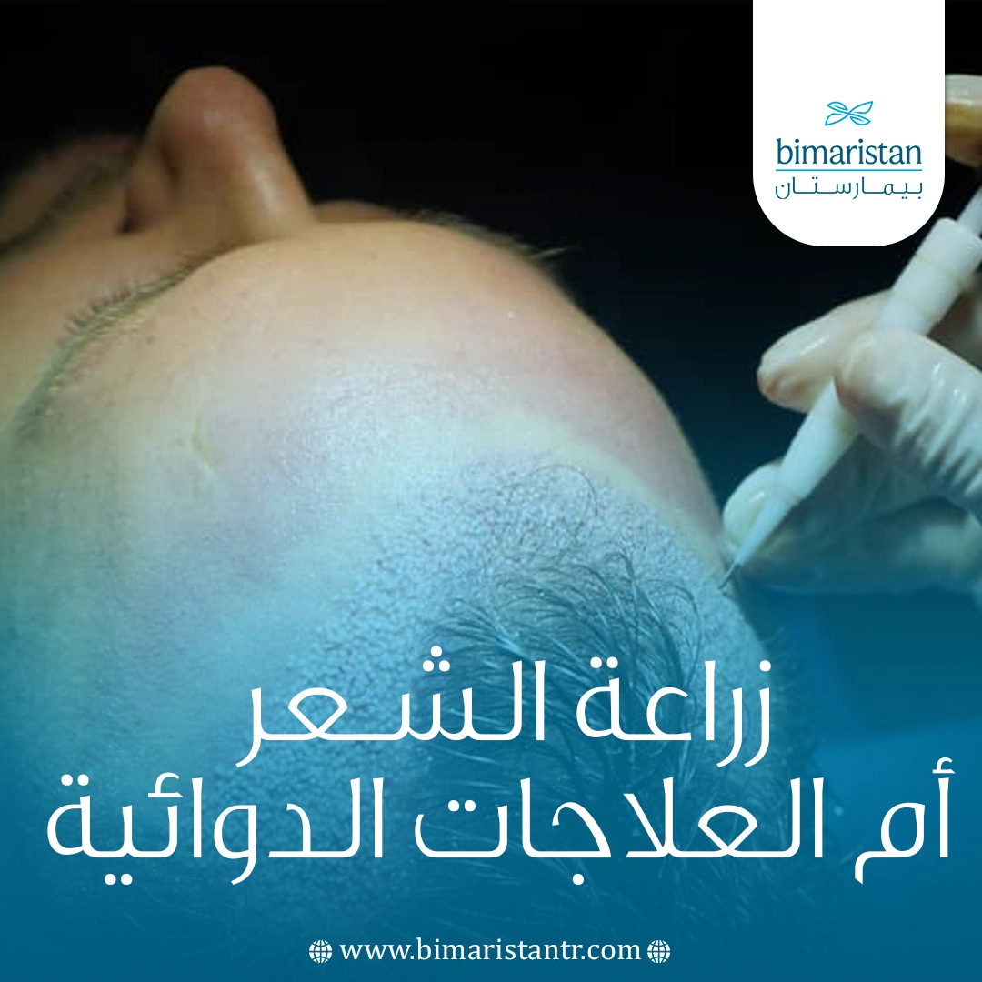زراعة الشعر أم العلاجات الدوائية