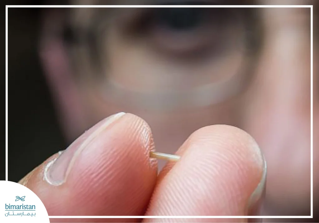 البذور المشعة الدائمة للبروستاتا: مراجعة شاملة 2 صورة توضح شكل وحجم البذور المشعة الدائمة للبروستاتا