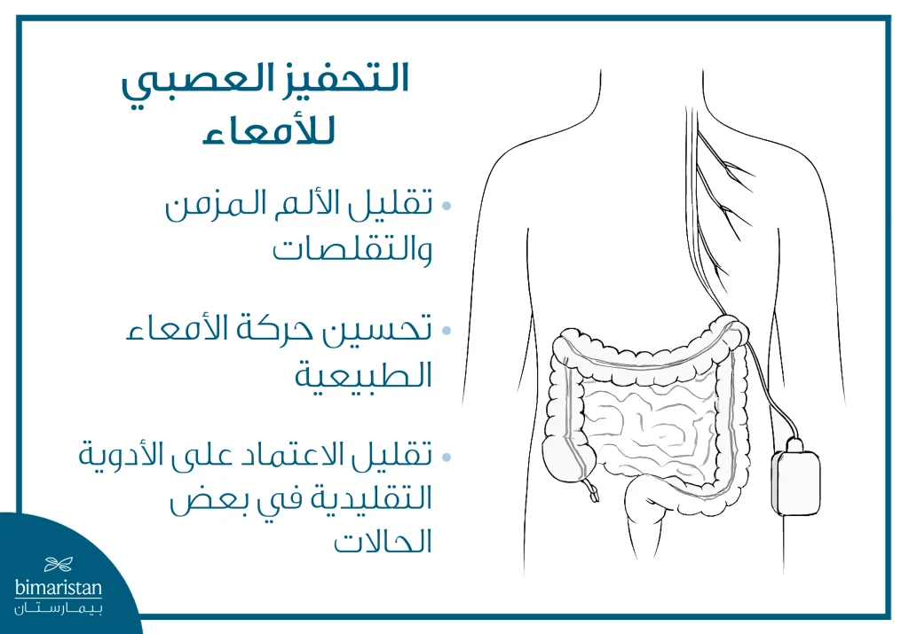 طرق علاج القولون العصبي: أعراضه وأحدث العلاجات 5 صورة توضح علاج القولون العصبي عن طريق التحفيز العصبي للأمعاء