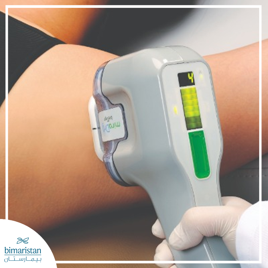 علاج فرط التعرق تحت الإبط بواسطة جهاز Miradry