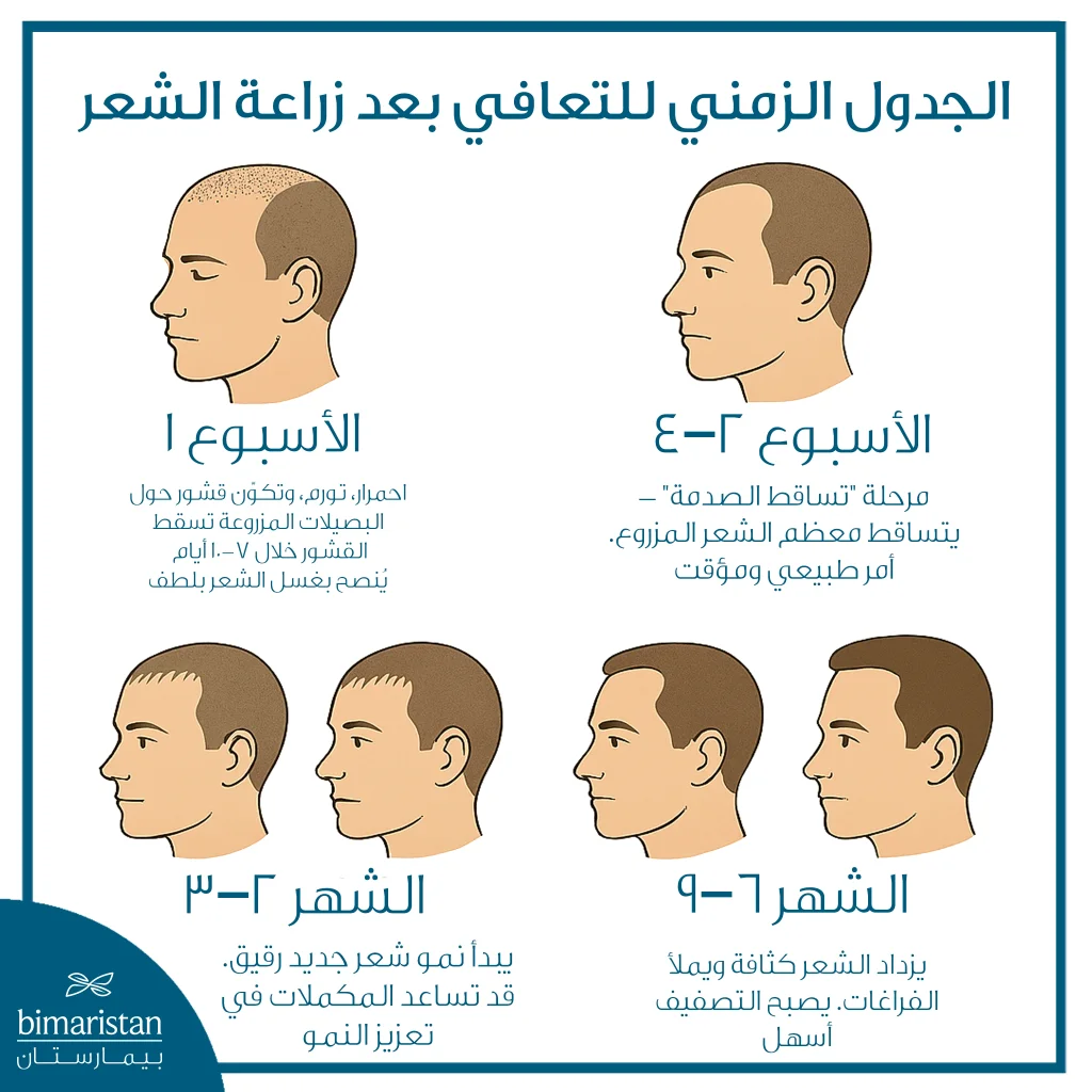 ديمومة زراعة الشعر: كيف يختلف عن الشعر الأصلي وأسرار الحفاظ عليه 2 مراحل تعافي زراعة الشعر من الأسبوع الأول حتى الشهر التاسع
