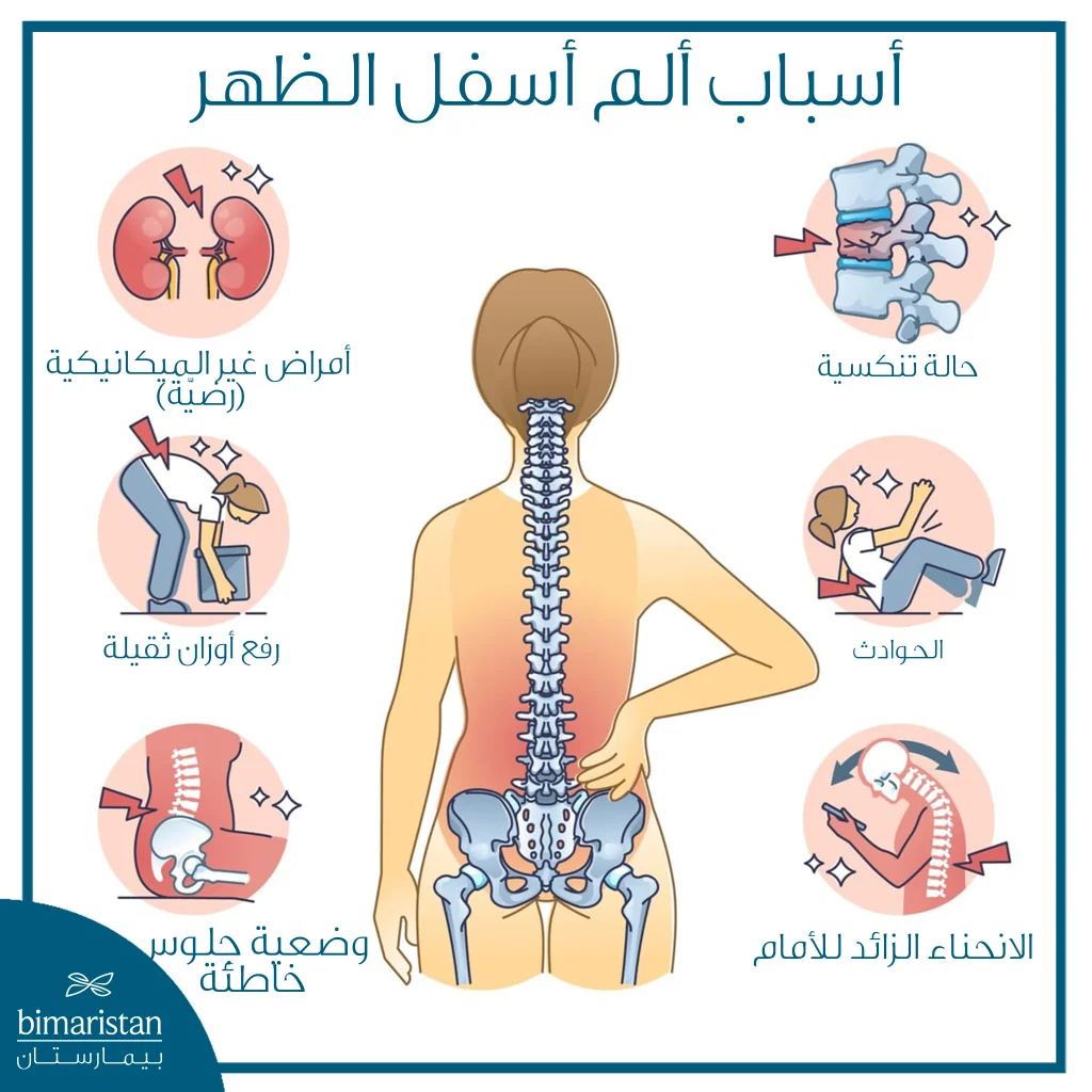 علاج ألم الظهر: أحدث الطرق الطبية لتخفيف الألم واستعادة الحركة 2 مسببات ألم الظهر السفلي
